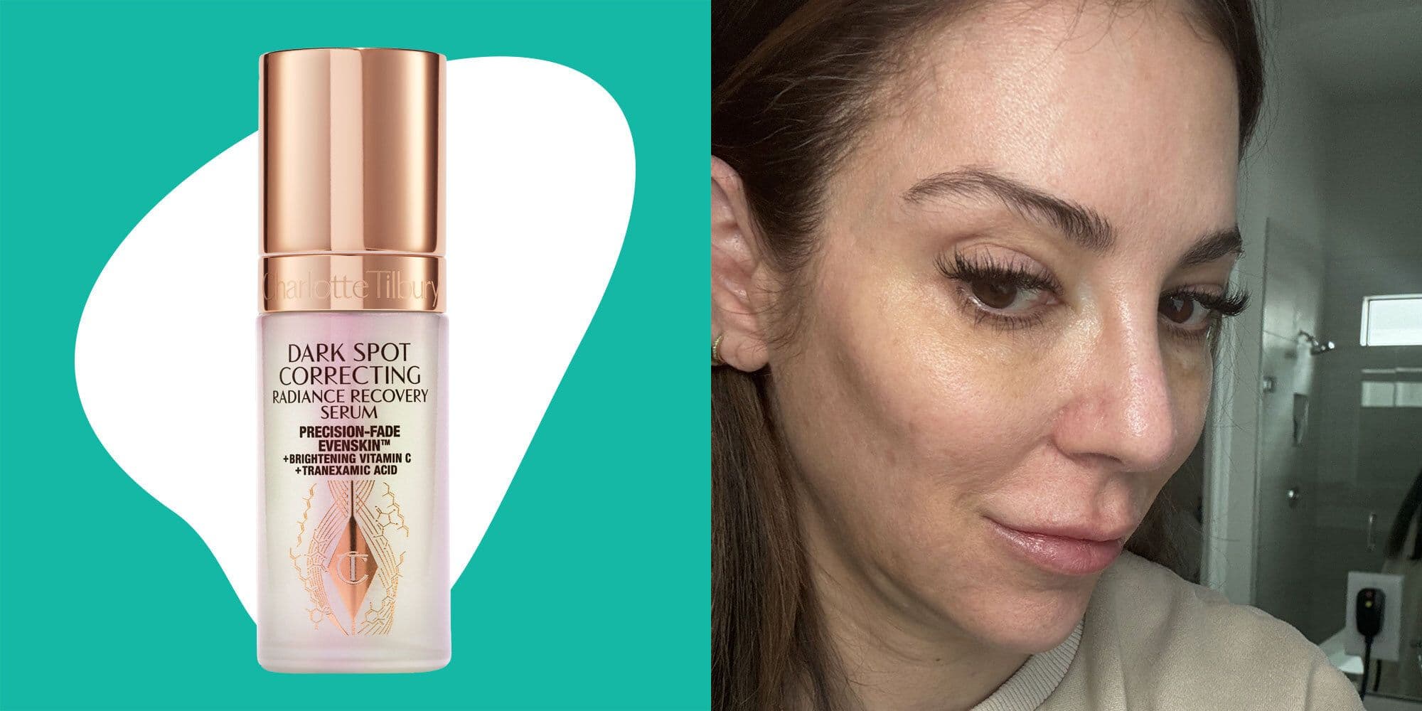 Charlotte Tilbury Dark Spot Correcting Radiance Recovery Serum Review: Pros, Cons, Is It Worth It?