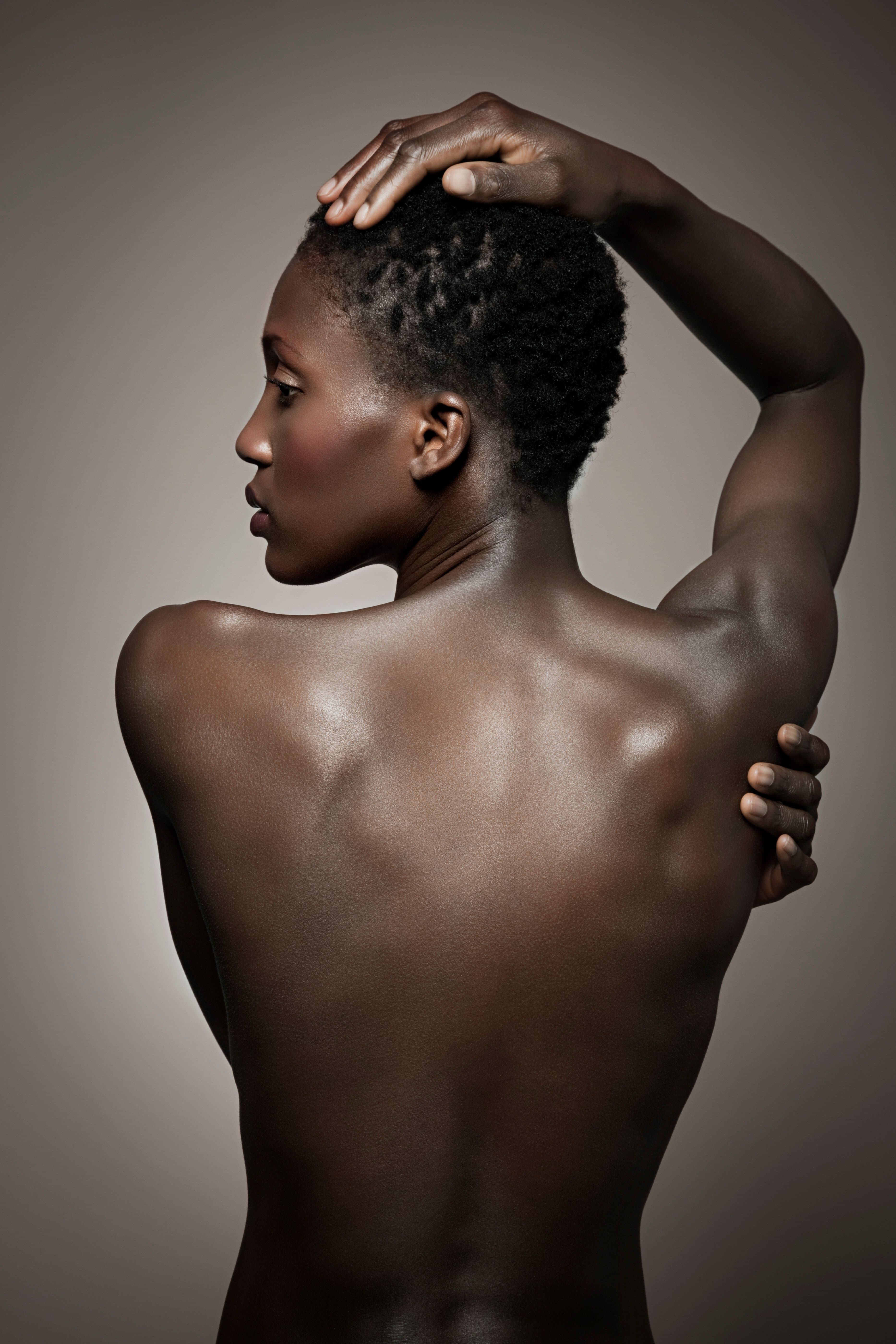 10 Million People Suffer From This Scalp Condition. Here's How One Woman Found Relief.