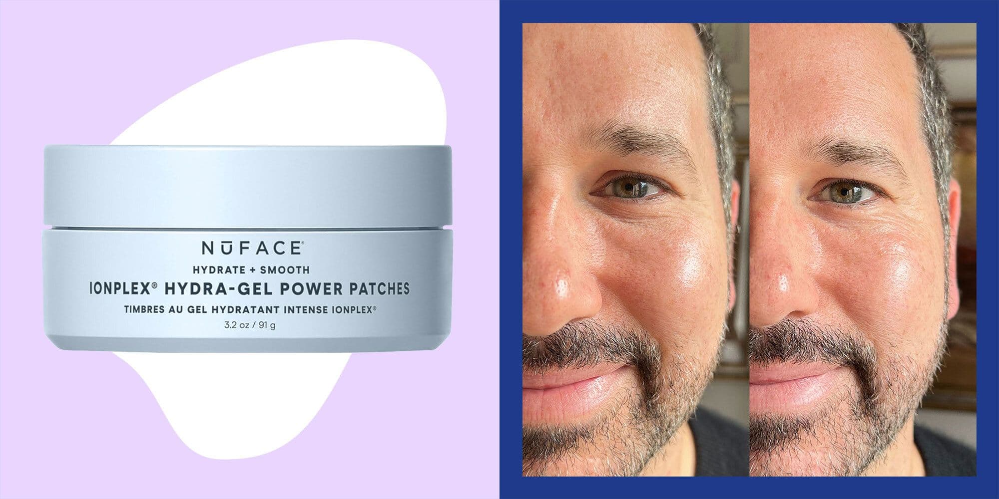 NuFACE Ionplex Hydra-Gel Power Patches: Our Honest Review Of This New Eye Product