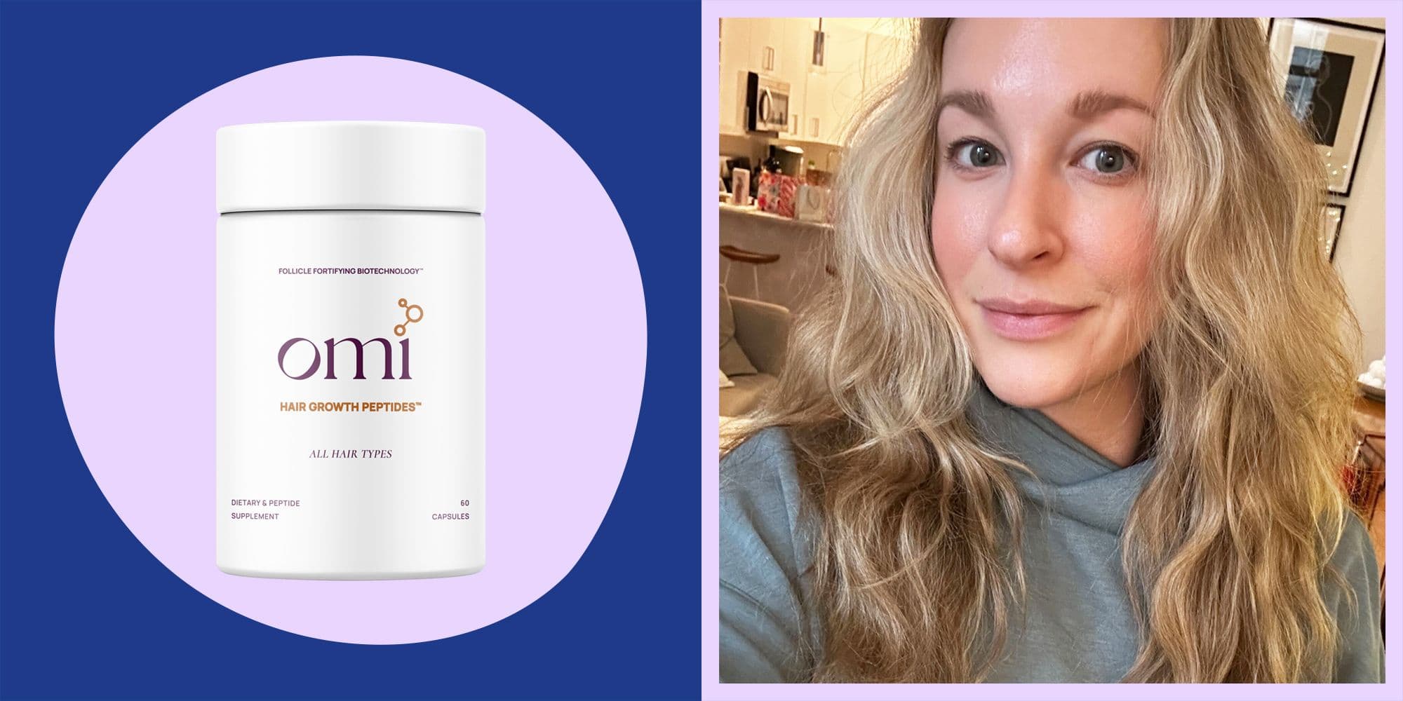 A-Listers Like Khloe Kardashian Are Obsessed With These Hair Growth Capsules, So We Put Them To The Test