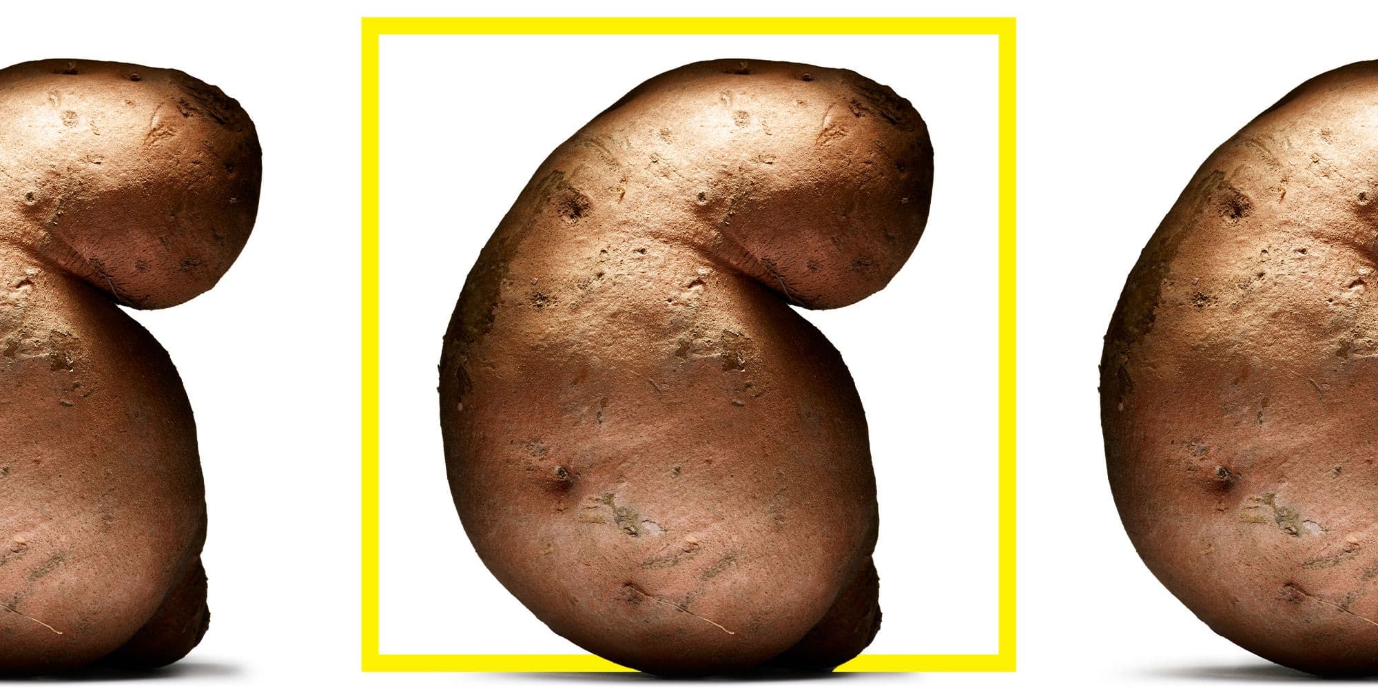 Before You Take a Resistant Starch Supplement, Try This