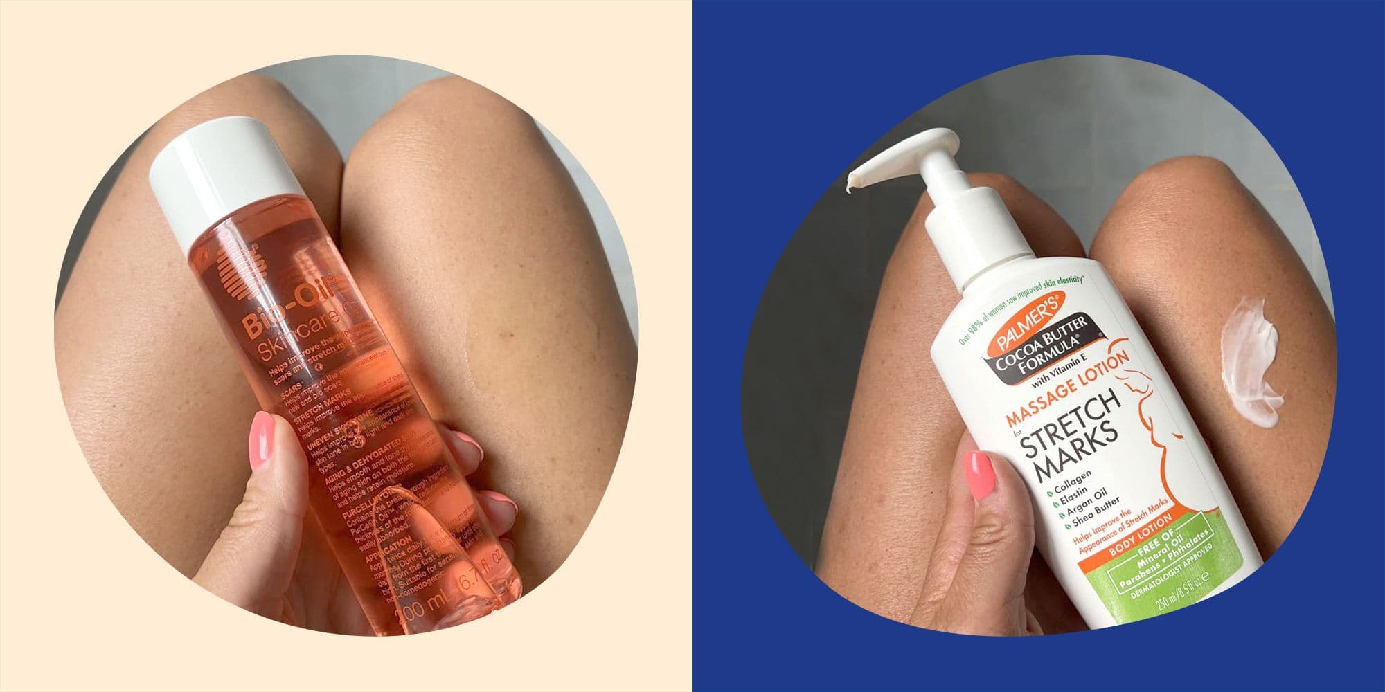 6 Best Stretch Mark Creams Money Can Buy, According To Dermatologists