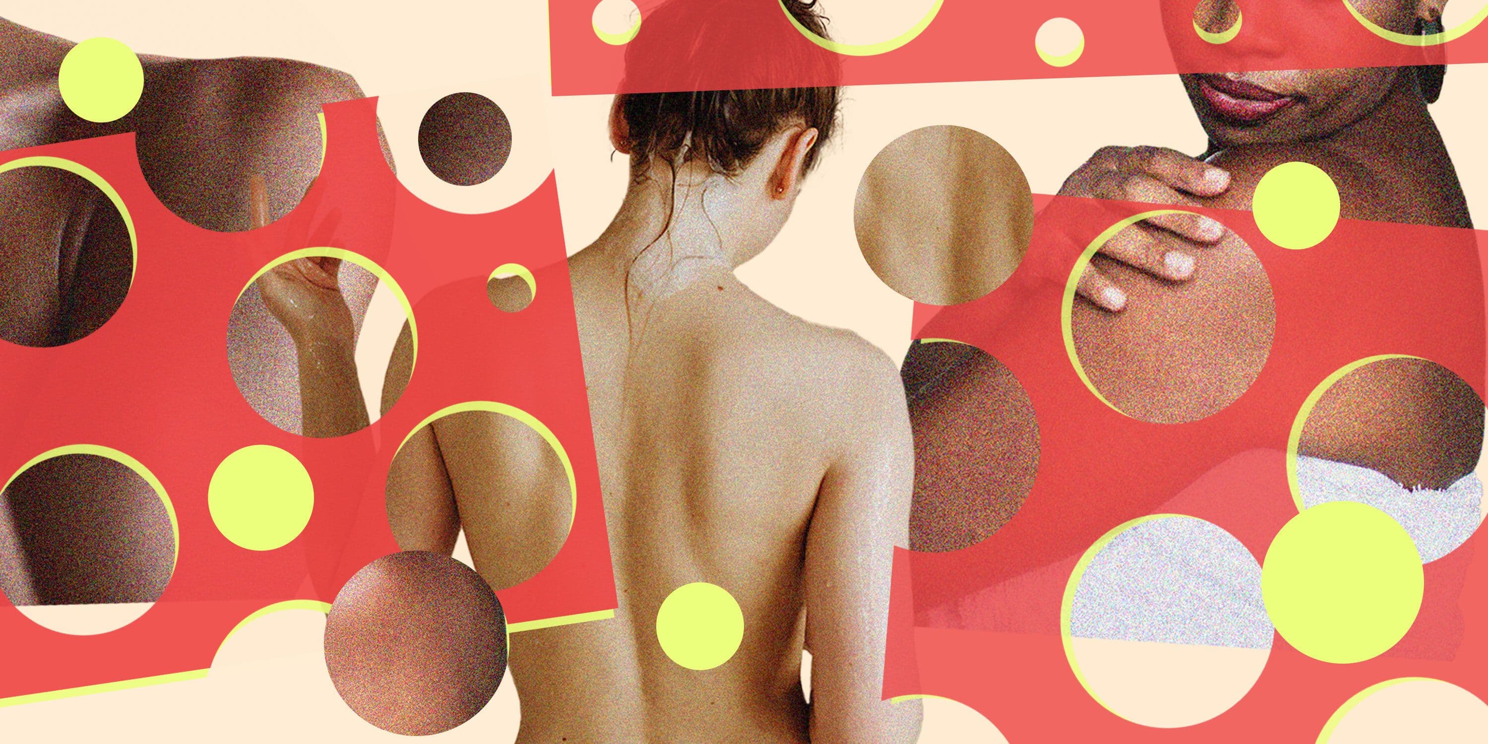 A Photo Guide To 20 Types Of Skin Bumps You Might Find On Your Body