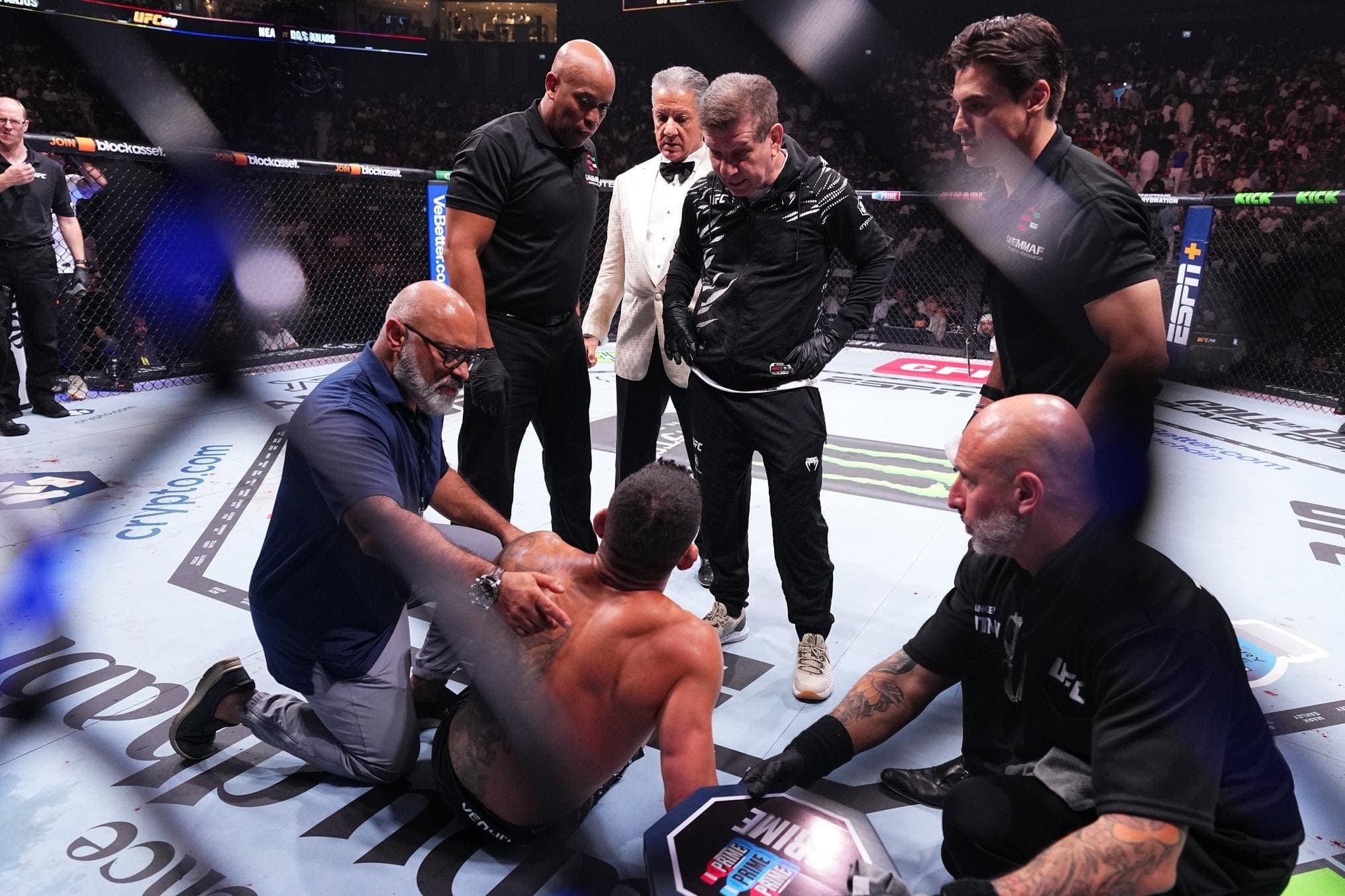 Former UFC Champion Reveals Major Injury: ‘My ACL Is Gone Guys’