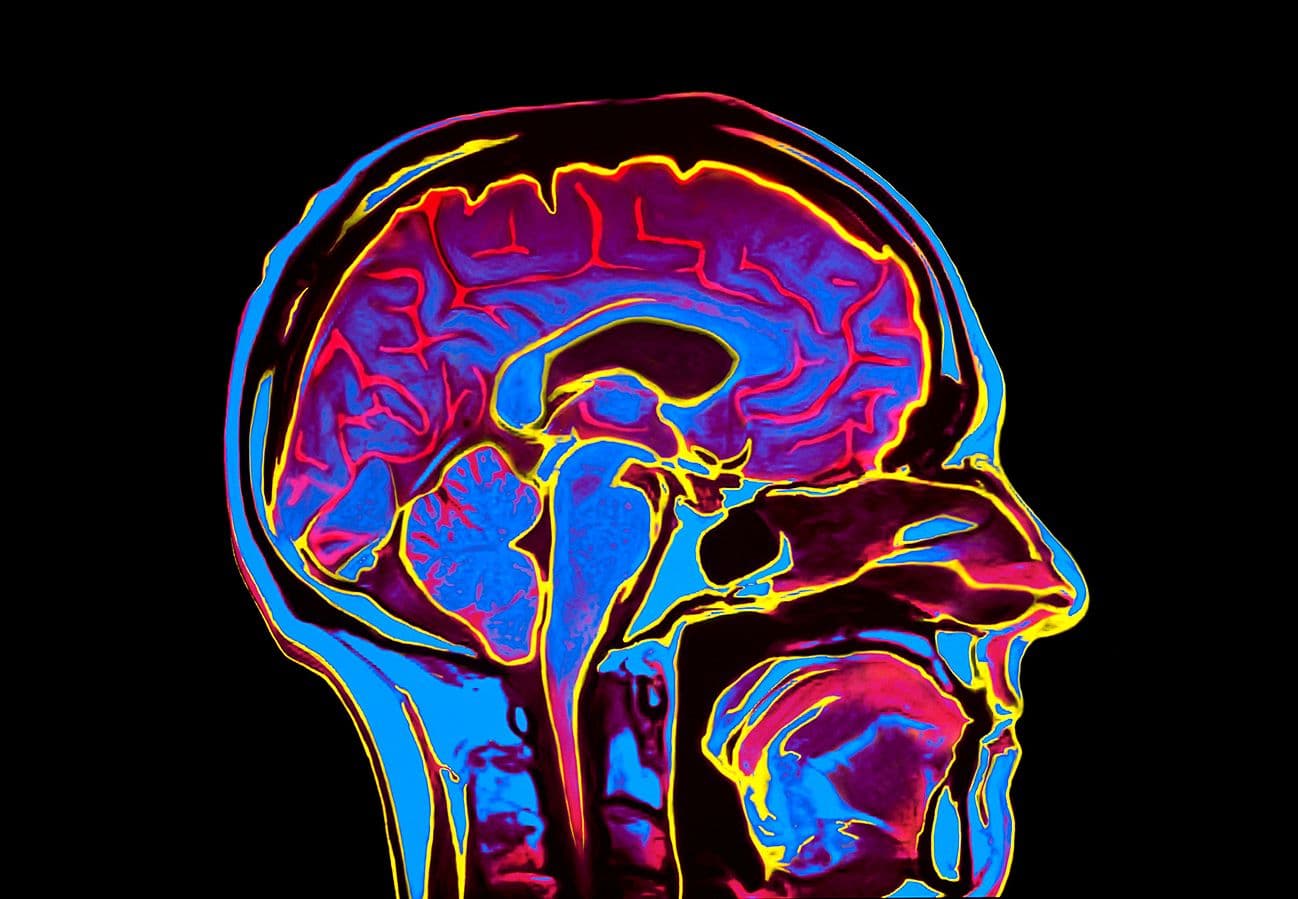Looking for Creativity in Brains Will Take More Creativity